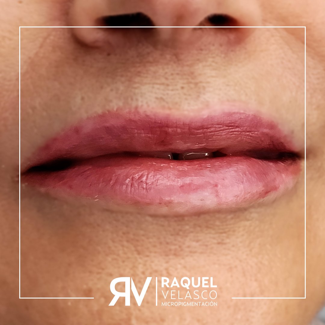 03-mantenimiento-labios-despues-laser-raquel-velasco-micropigmentacion-madrid