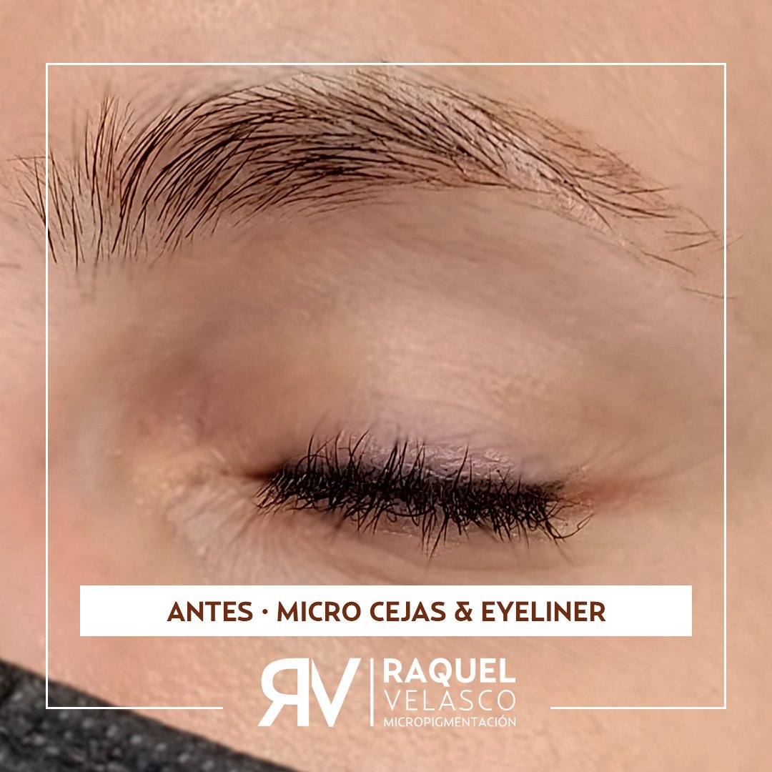 antes-cejas-eyeliner-raquel-velasco-micropigmentacion-madrid-mejor-micropigmentadora-madrid