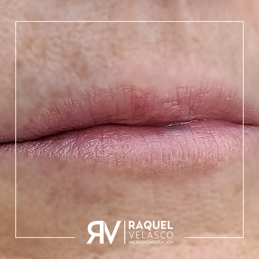 antes-lips-labios-hiperrealista-raquel-velasco-micropigmentacion-madrid-mejor-micropigmentadora-madrid-antes-despues-pelo-a-pelo copia