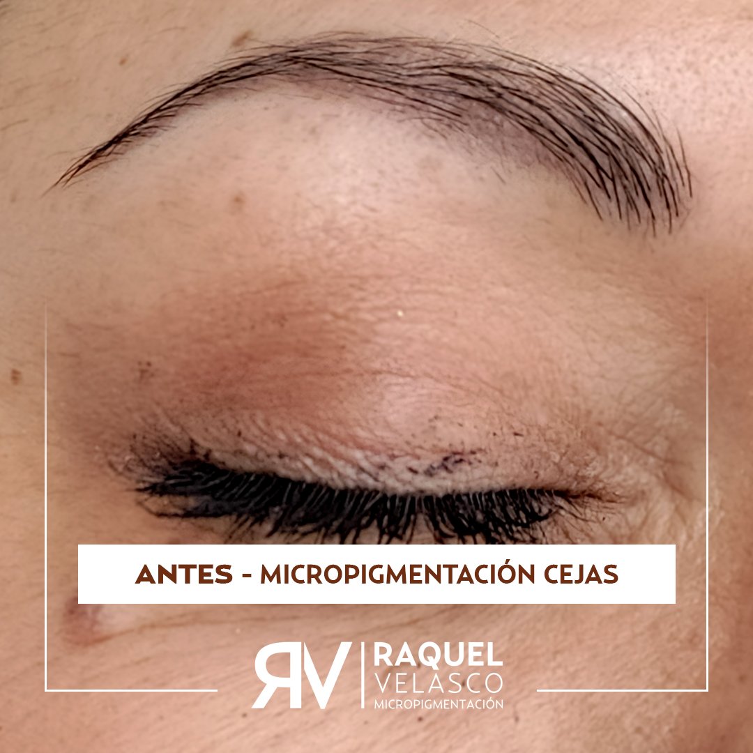 antes-micropigmentacion-cejas-raquel-velasco-mejor-madrid