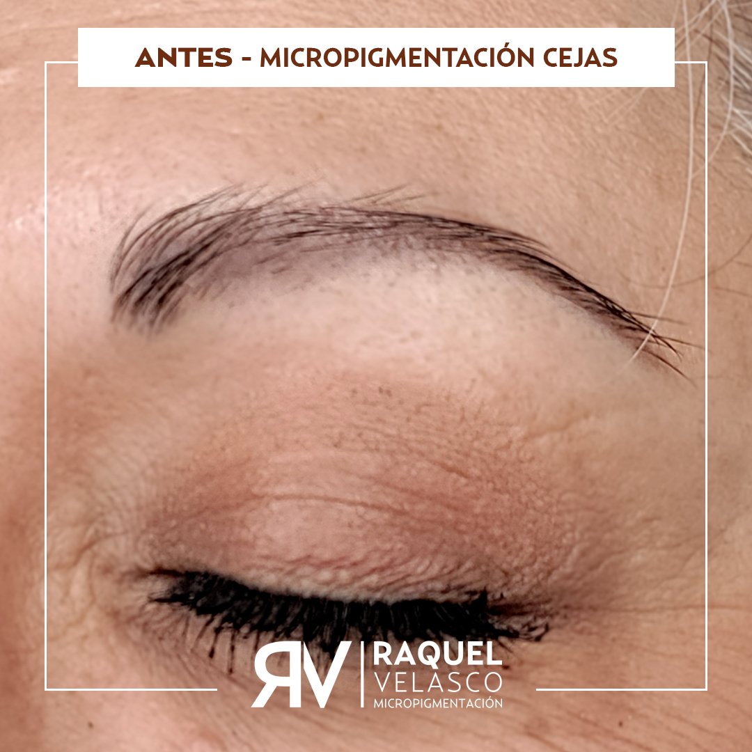 antes-micropigmentacion-cejas-raquel-velasco-mejor-madrid